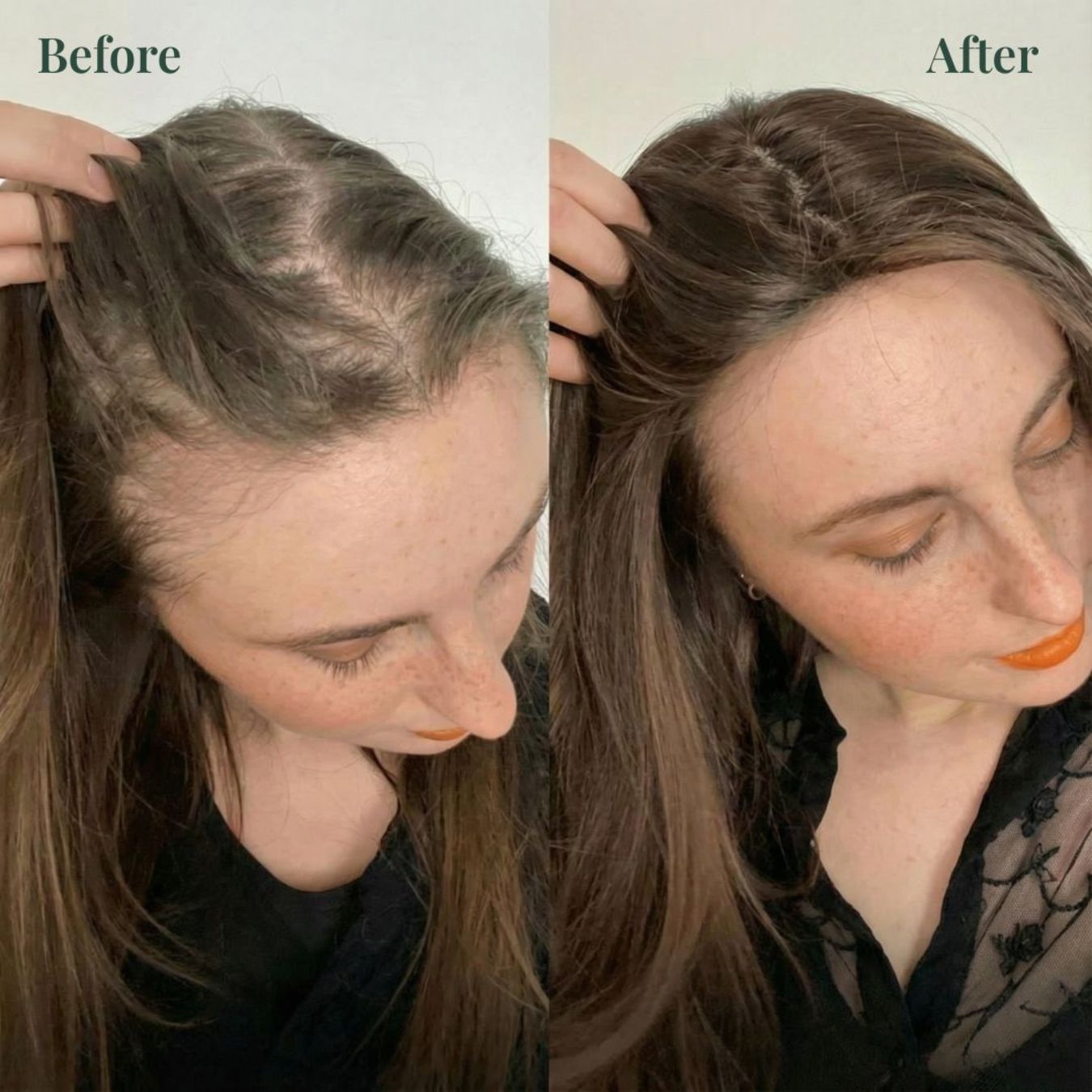 Whiton Hair Growth Support Shampoo