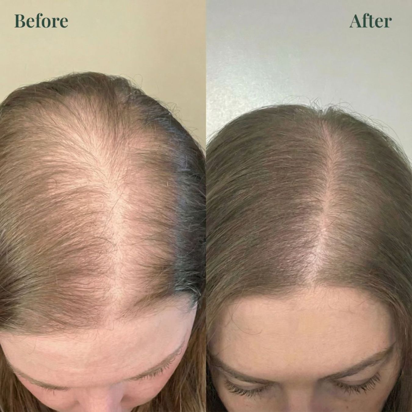 Whiton Hair Growth Support Shampoo