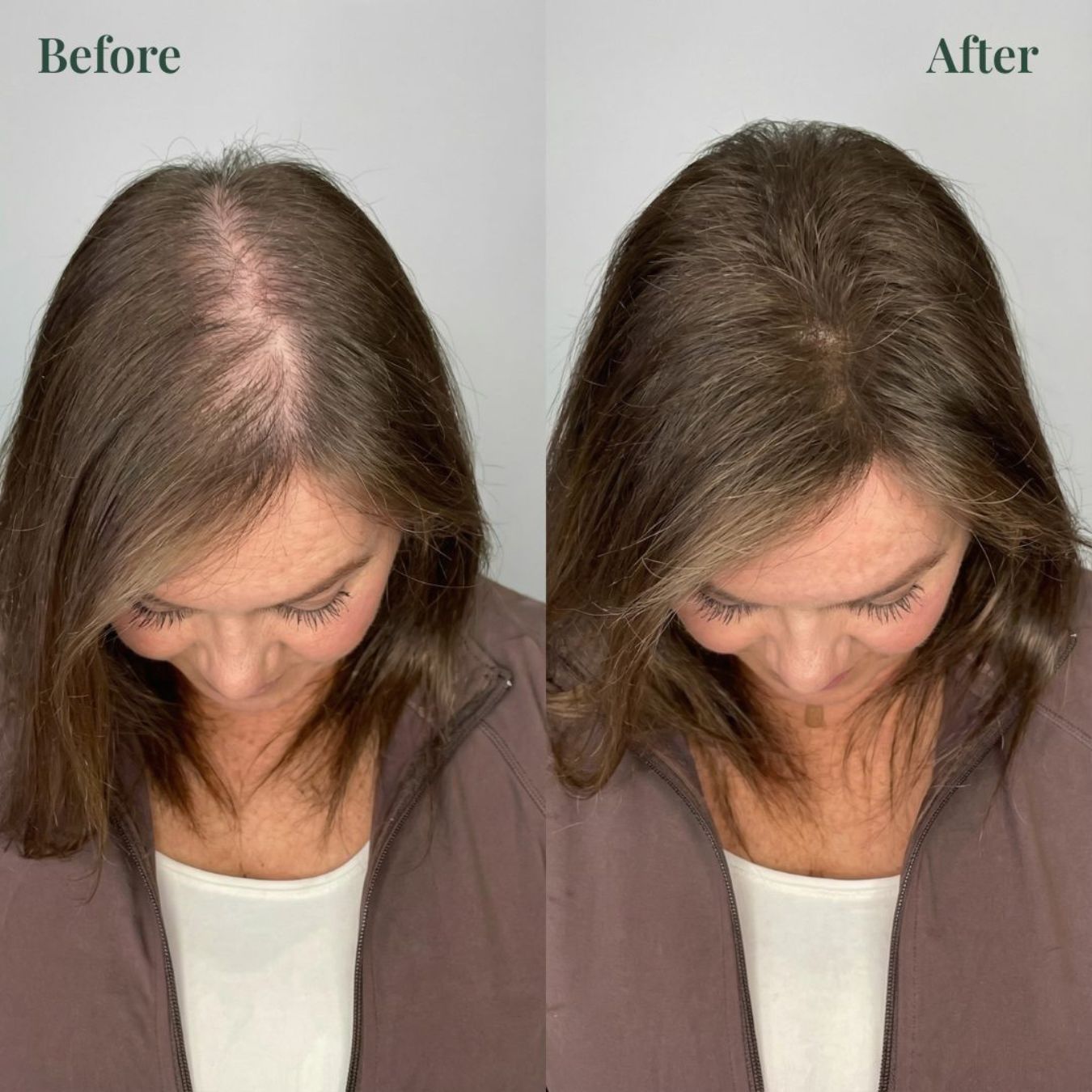 Whiton Hair Growth Support Shampoo