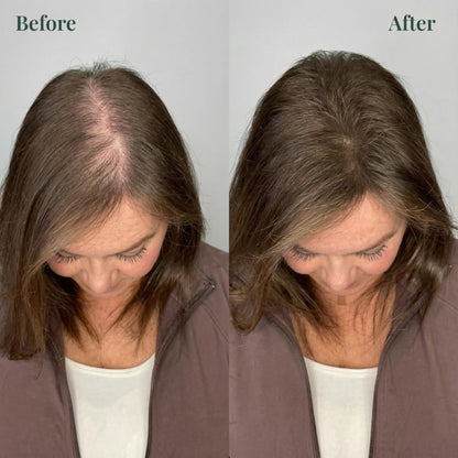 Whiton Hair Growth Support Shampoo