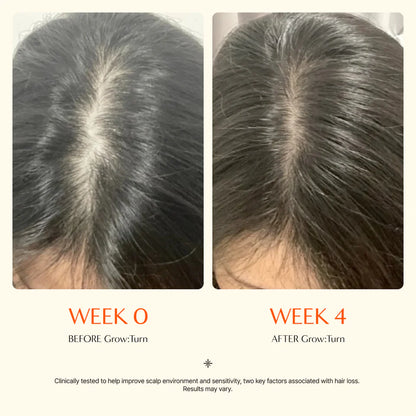 GrowTurn Hair Growth Serum