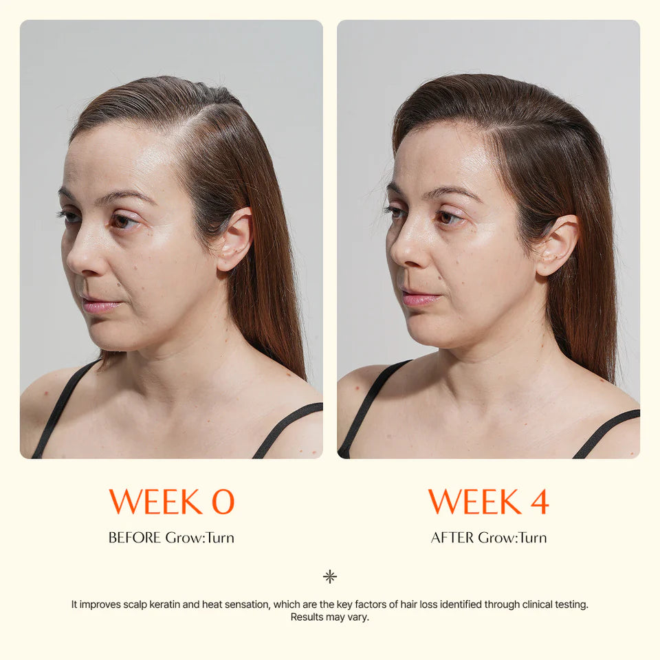 GrowTurn Hair Growth Serum