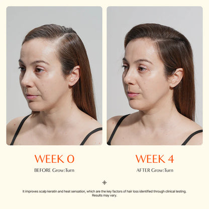 GrowTurn Hair Growth Serum