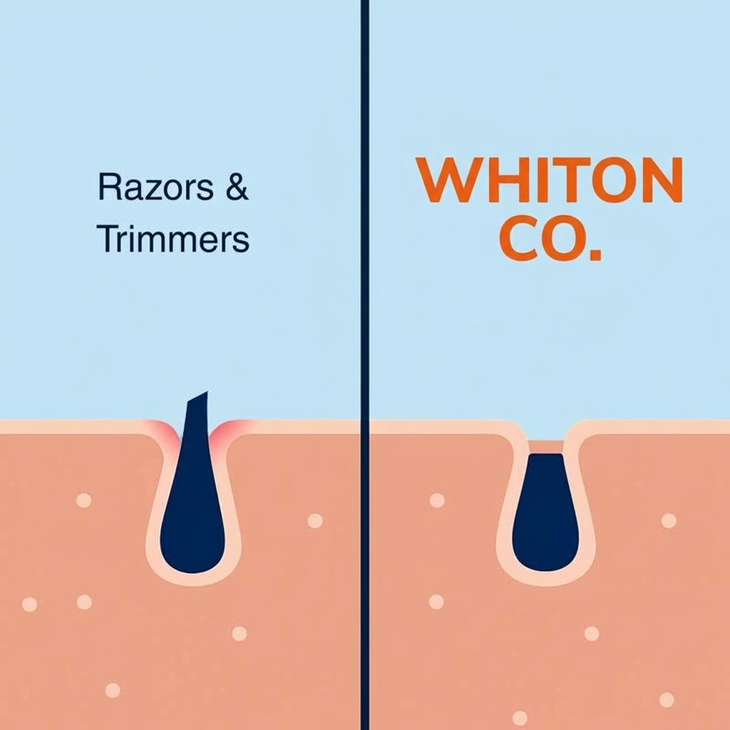Whiton Intimate Hair Removal Cream