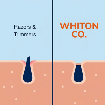 Whiton Intimate Hair Removal Cream
