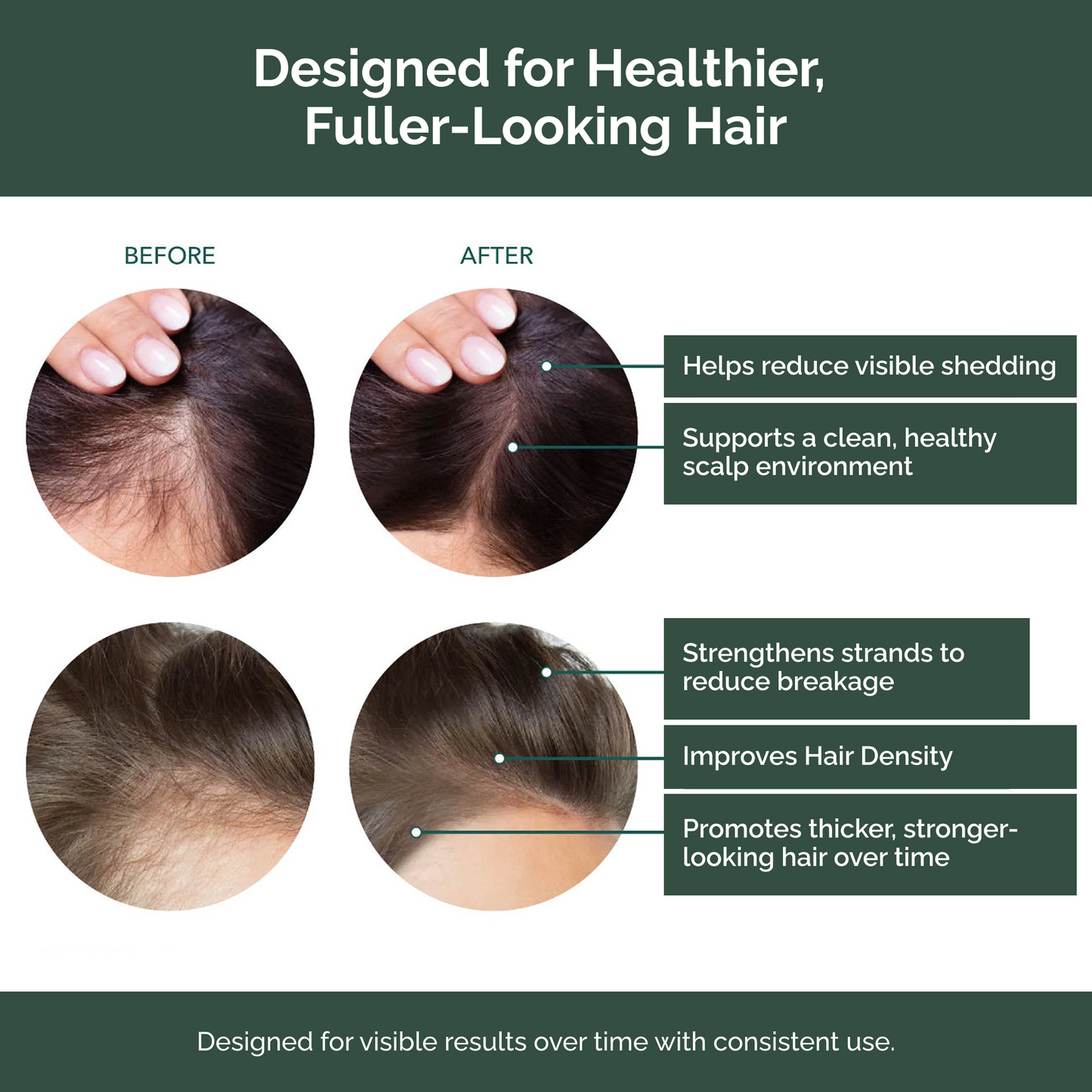 Whiton Hair Growth Support Shampoo
