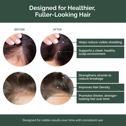 Whiton Hair Growth Support Shampoo